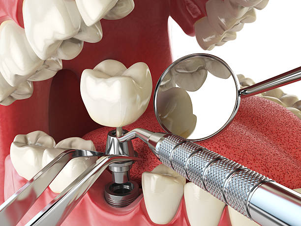 Best Emergency Broken Tooth Repair in Osgood, IN